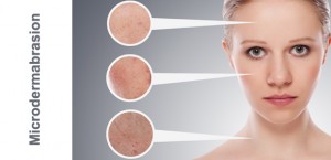 روش انجام درم ابریژن و میکرودرم ابریژن