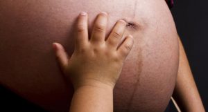 بهترین نکات بارداری-پوست: تغییرات پوستی تیرگی ناف و ترک های بارداری