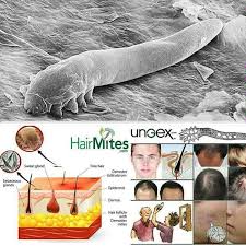 1 2 - انگل دمودکس عامل ریزش موی سر را بشناسید!