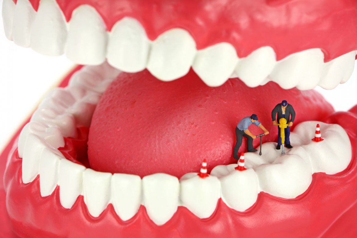 کشی درمان ریشه دندان چیست - آسیب دیدگی مغز دندان را بهتر بشناسید!