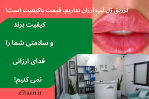 تزریق ژل لب ارزان