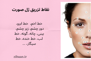 نقاط و نواحی تزریق فیلر در صورت