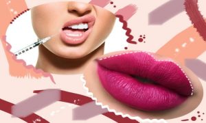 عوارض تزریق ژل لب