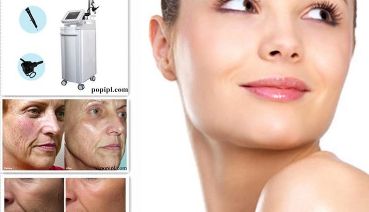 rf-fractional-co2-laser-acne-scare-removal-beauty-1262388