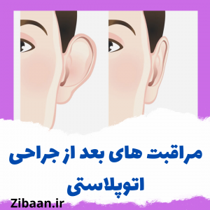 جراحی زیبایی گوش