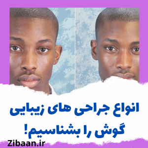 جراحی زیبایی گوش
