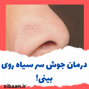 درمان جوش سرسیاه