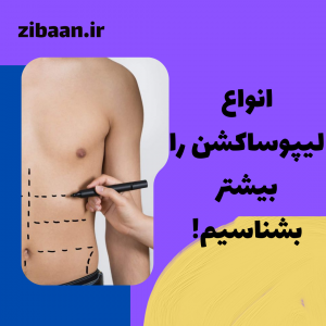 پیکرتراشی چیست؟