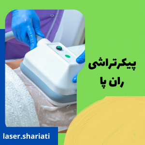 هزینه پیکرتراشی