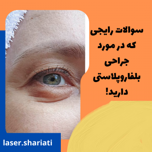 هزینه بلفاروپلاستی