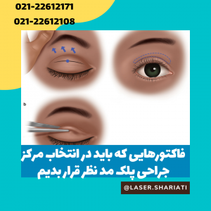 جراحی افتادگی پلک در تهران