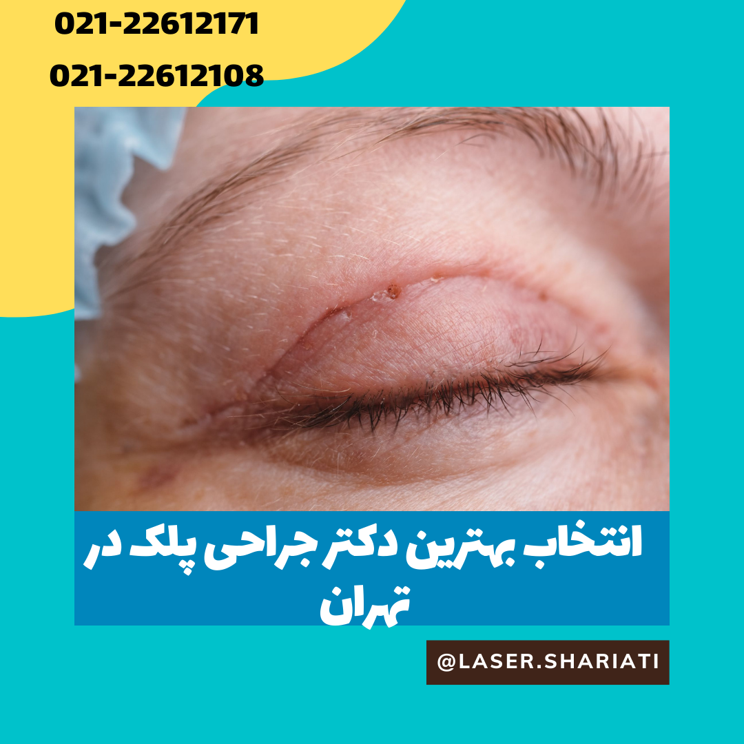 دوره های آموزش آنلاین 2022 07 19T164522.542 - جراحی افتادگی پلک در تهران