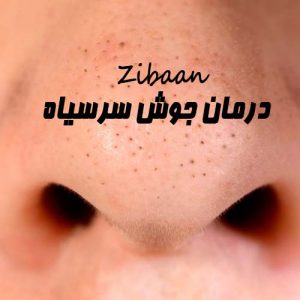 درمان جوش سرسیاه