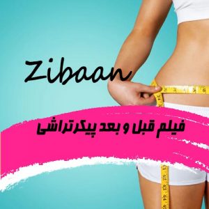 فیلم قبل و بعد عمل پیکرتراشی