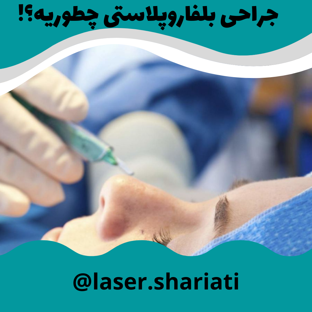 بهترین جراح پلک ایران