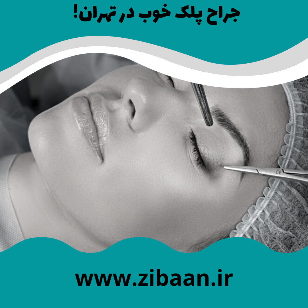 جراح پلک خوب در تهران