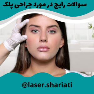 بهترین جراح پلک ایران