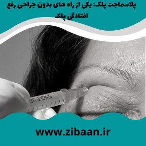 هزینه عمل بلفاروپلاستی یا لیفت نخ