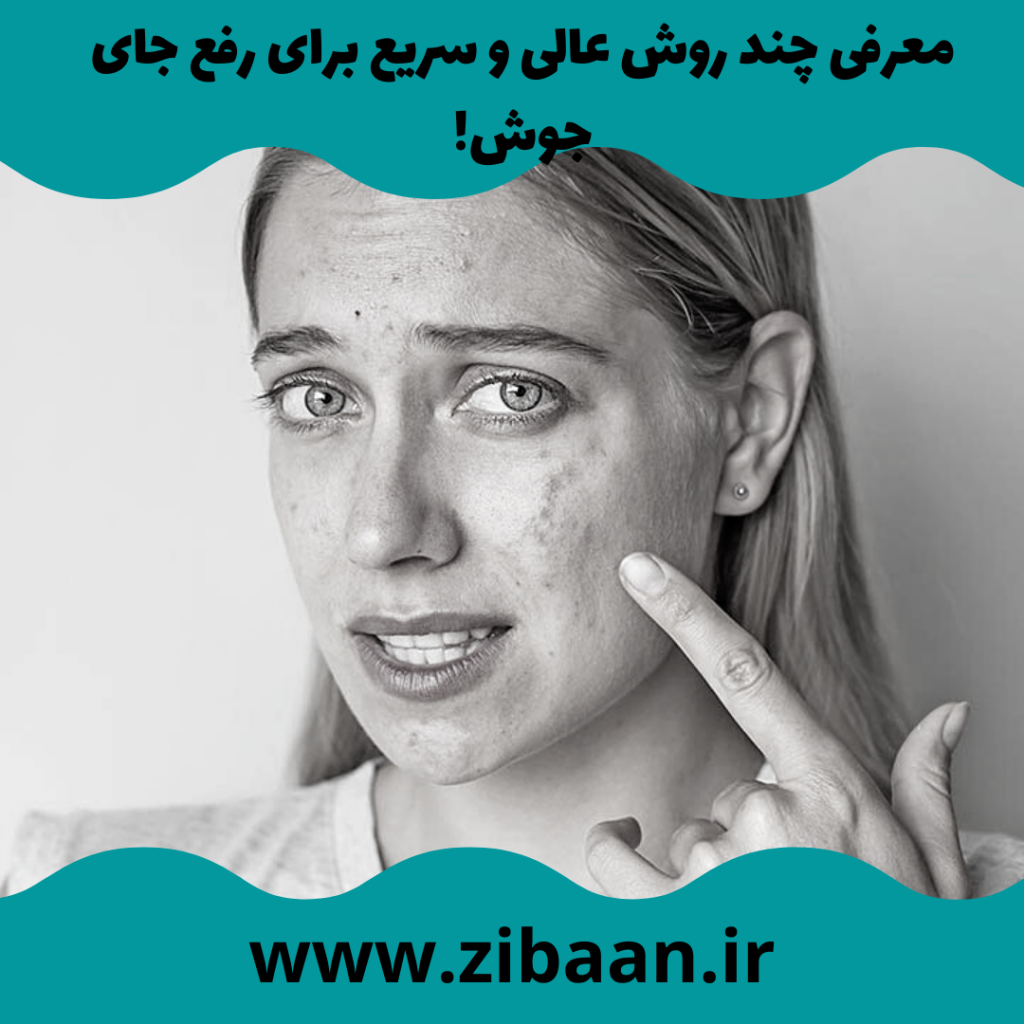 سریع ترین راه رفع جای جوش