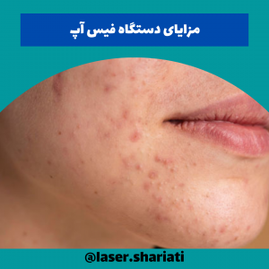 سریع ترین راه رفع جای جوش