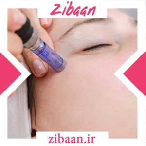 جوانسازی با میکرونیدلینگ