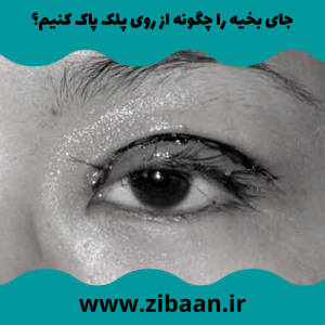 مراقبت بعد از عمل بلفاروپلاستی جای بخیه