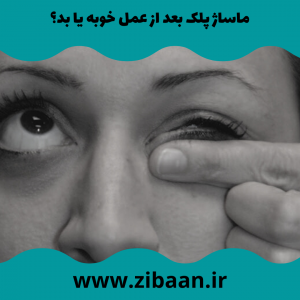 مراقبت بعد از عمل بلفاروپلاستی