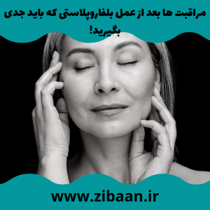 مراقبت بعد از عمل بلفاروپلاستی