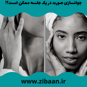 جوانسازی صورت در یک جلسه