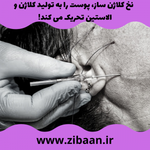 جوانسازی صورت با نخ