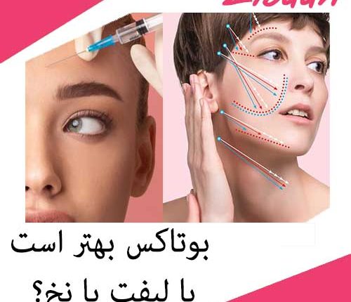 بوتاکس بهتر است یا لیفت با نخ