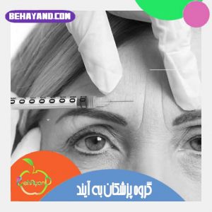 بوتاکس بهتر است یا لیفت با نخ