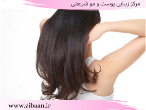 هیر فیلر مو