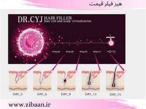 هزینه تزریق هیر فیلر