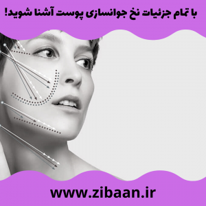هزینه لیفت با نخ