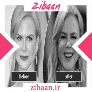 سریع ترین راه جوانسازی پوست