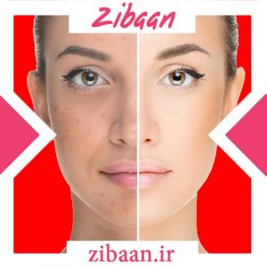 سریع ترین راه جوانسازی پوست