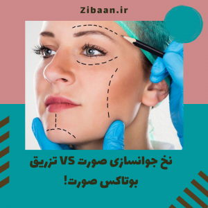 نخ جوانسازی صورت با تزریق بوتاکس