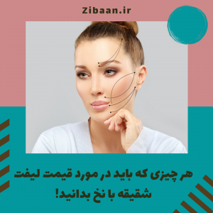 لیفت شقیقه با نخ