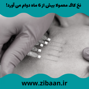دوام نخ کاگ برای لیفت صورت