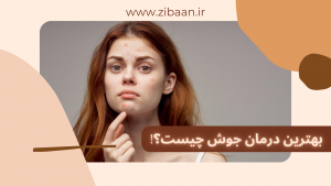آیا میکرونیدلینگ برای جوش خوب است