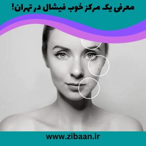 مرکز فیشیال صورت