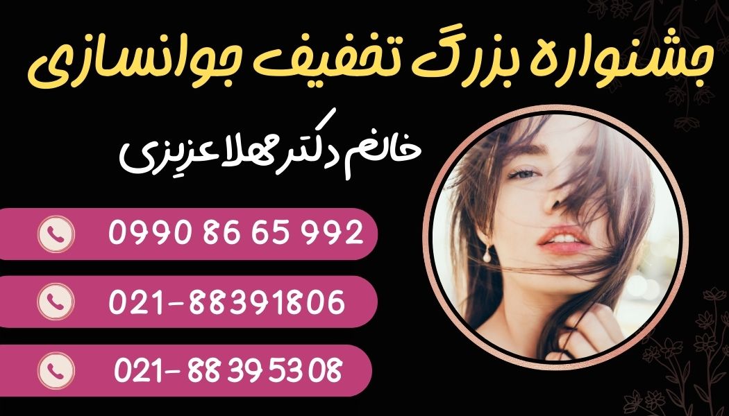 تخفیف جوانسازی