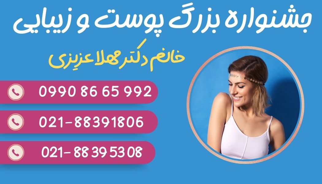 تماس